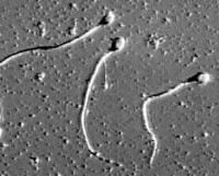 sperms.jpg